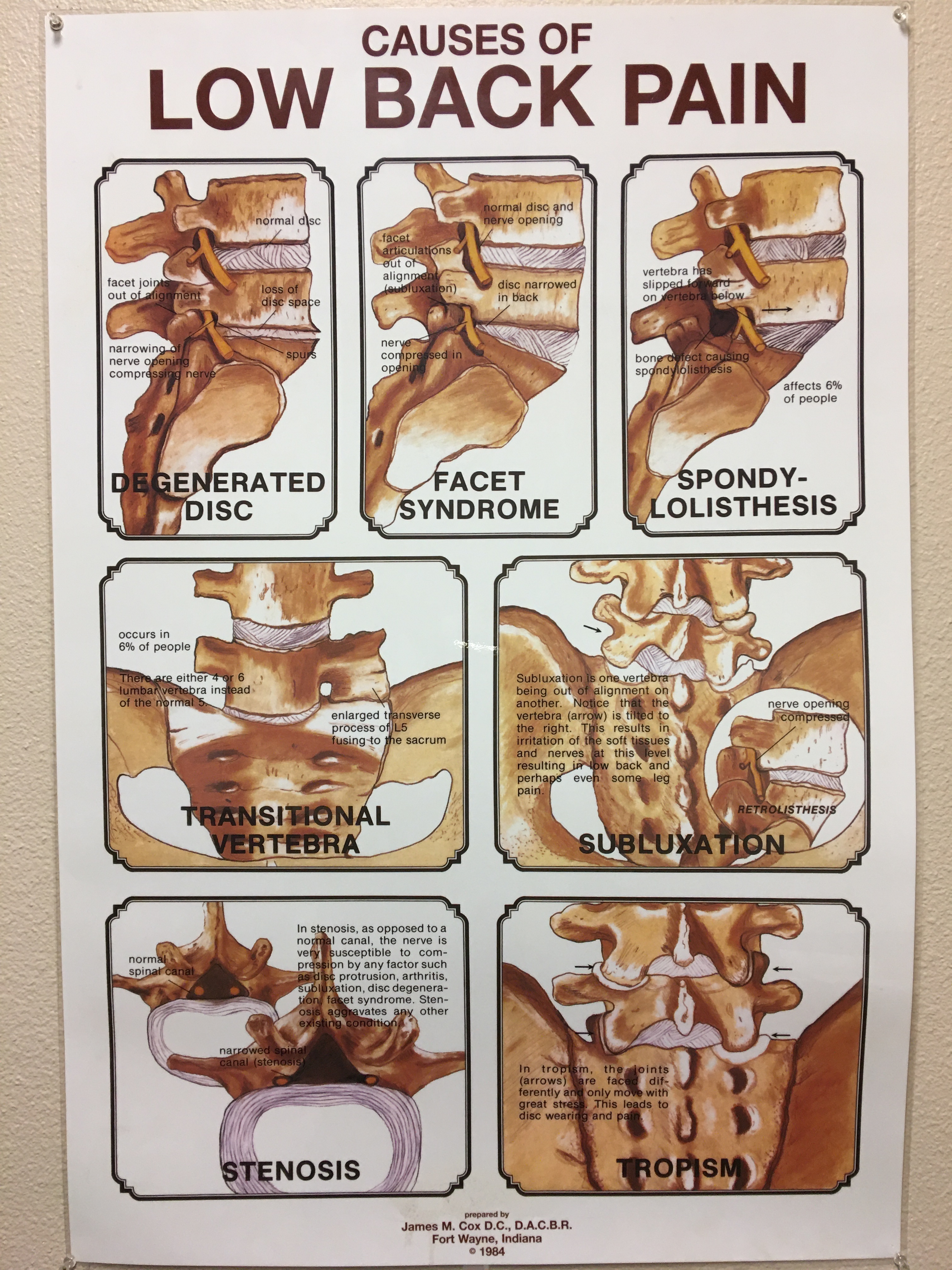 Lower Back Pain Original Poster
